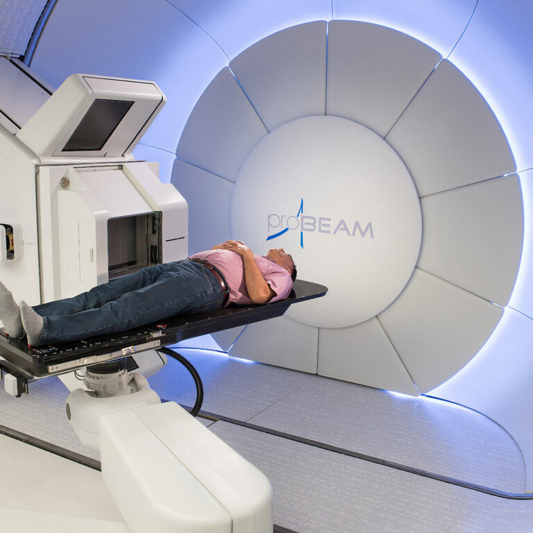 Brain cancer proton beam therapy treatment