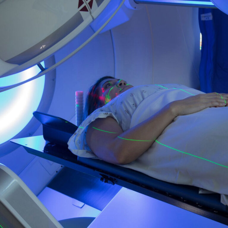 Patient having proton beam therapy